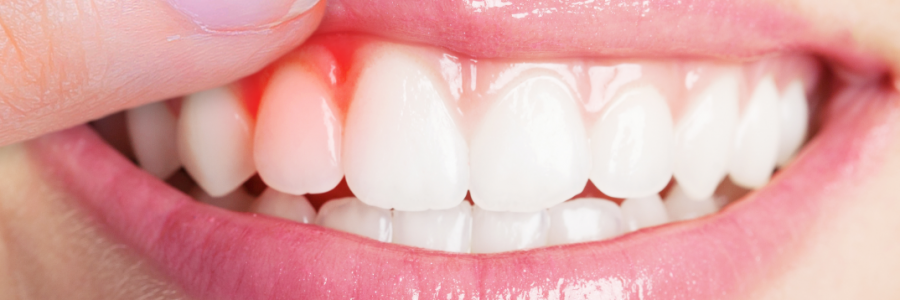 又上火又怕冷？上熱下寒、水火不濟(jì)，教你調(diào)回來(lái)！