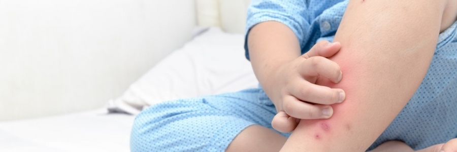 學(xué)古人這樣驅(qū)蚊，從此不再“蚊”風(fēng)喪膽！