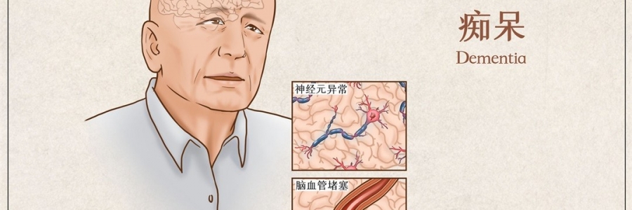 “馬什么梅？”年紀(jì)輕輕老忘事，竟是癡呆的前兆？！