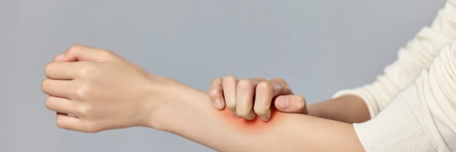 濕疹、瘙癢、蕁麻疹……患皮膚病，也許是好事！