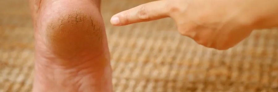 每天跺跺腳，從腳養(yǎng)到頭，越跺越年輕！